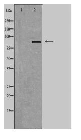 TACC1 Antibody