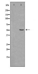 PPP2R2A Antibody