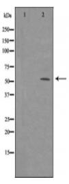 ME1 Antibody