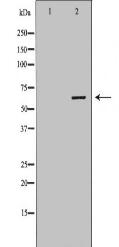 IGF2BP1 Antibody