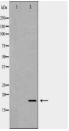 MAX Antibody