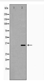 PPP2CB Antibody