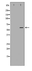 RIPK2 Antibody