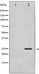 TK Antibody