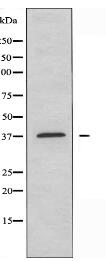 OR2B8 Antibody