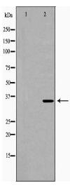 P2RY6 Antibody