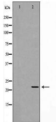 PSMB2 Antibody