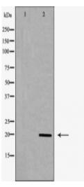 MRLC2 Antibody