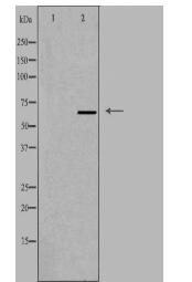 PPP2R1B Antibody