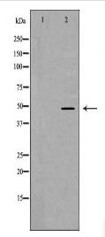 TACR1 Antibody