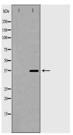 TOR1A Antibody