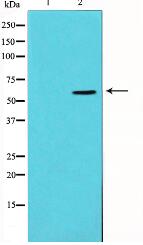 Vimentin Antibody