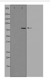 RFWD3 Antibody