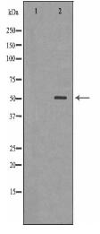 RARA Antibody