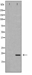 IFN-γ Antibody