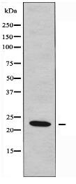 UBE2T Antibody