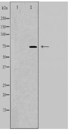 SLC27A5 Antibody