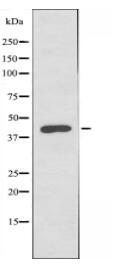 LW-1 Antibody