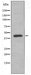 PAR4 Antibody