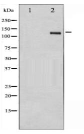 Integrin beta3 Antibody