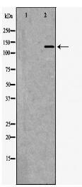 TYK2 Antibody