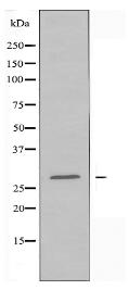 RNF138 Antibody