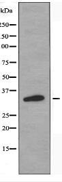 OR2T2/2T35 Antibody