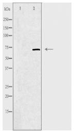 ZNF147 Antibody