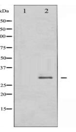 SNAI1 Antibody