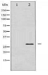TNNI3 Antibody