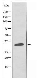 OR5P3 Antibody