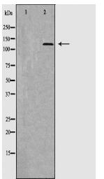 THBS1 Antibody