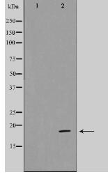 CDKAP1 Antibody