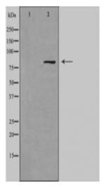 MARK2 Antibody