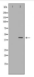 TRIM63 Antibody