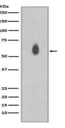 Phospho-c-Myc (T58 + S62) Antibody