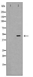 IL1R2 Antibody
