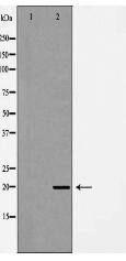 twist Antibody