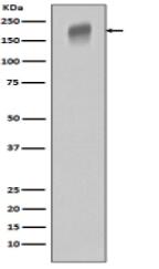 VEGF Receptor 1 Antibody