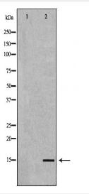 NPPB Antibody