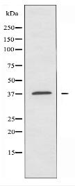 OR51B2 Antibody