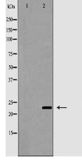 CD8B Antibody