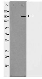 WHSC1L1 Antibody