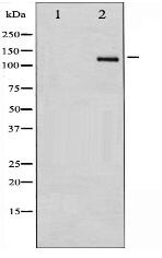 PDGFR beta Antibody