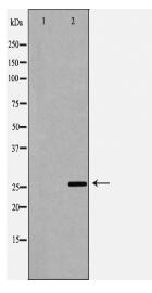 TREM1 Antibody