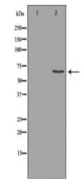 MMP14 Antibody