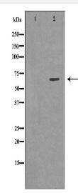 KBTBD3 Antibody
