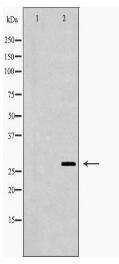 NR0B2 Antibody