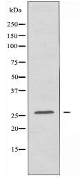 HOXA6 Antibody