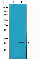 Gamma-synuclein Antibody